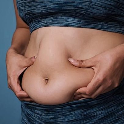 Cinco formas simples de reduzir gordura abdominal