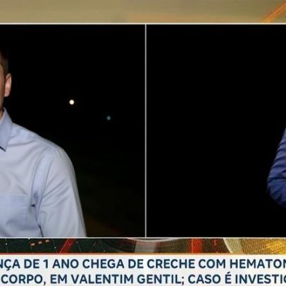 Bebê de 1 ano chega da creche com hematomas e suspeita de fratura no nariz