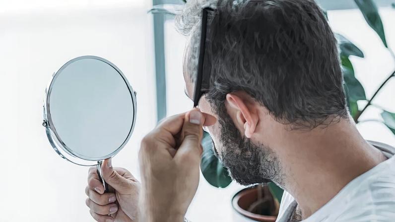 Calvície sob controle: causas, tratamentos eficazes e cuidados diários