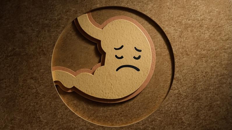 Imagem conceitual de um estômago feito de feltro com uma carinha triste. Dor de estômago. Metrópoles