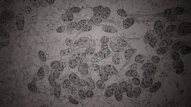 Células cancerígenas possuem uma “memória”, que as ajudam a transmitir para outras gerações de células a capacidade de resistir a tratamentos — Foto: Flickr