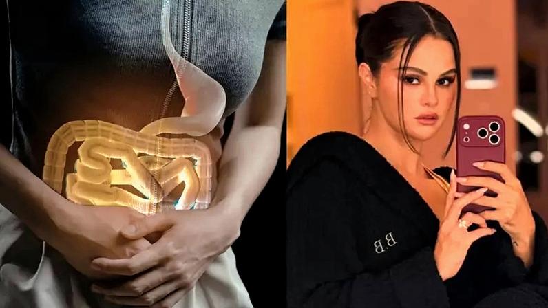 Entenda o que é SIBO, condição intestinal citada por Selena Gomez, seus sintomas, causas e como é feito o diagnóstico e tratamento