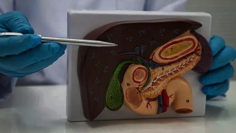 Dor abdominal após refeições pode indicar pedra na vesícula; entenda os sintomas, riscos e quando a cirurgia é indicada