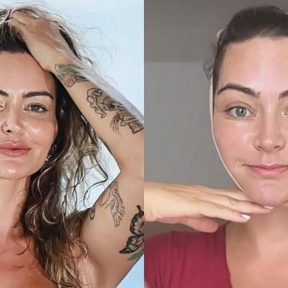 Laura Keller usa enfaixado após cirurgia facial e exibe pontos
