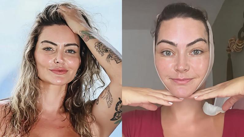 Laura Keller usa enfaixado após cirurgia facial e exibe pontos