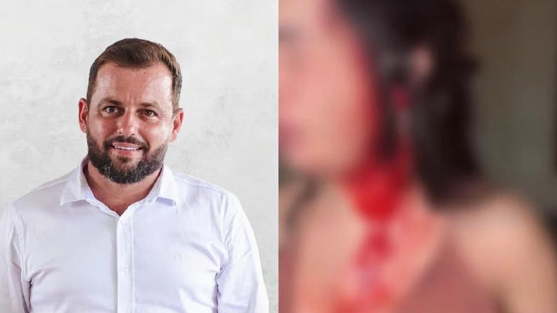 O homem negou as acusações e alegou ter sido agredido primeiro, versão que não foi confirmada por testemunhas.