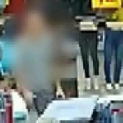 Homem baleado na cabeça em SP sobrevive; filha afirma que osso frontal salvou