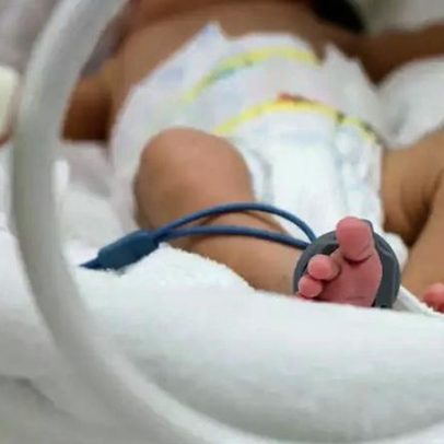 Sociedade de Pediatria explica riscos da bactéria na UTI do Hospital Fêmina