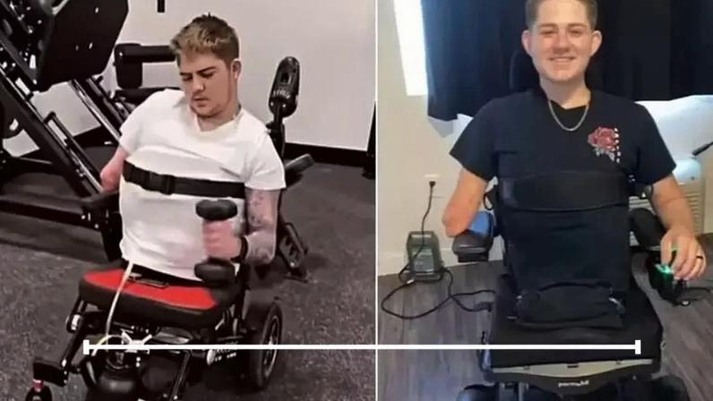 Loren Schauers perdeu metade do corpo em acidente com empilhadeira