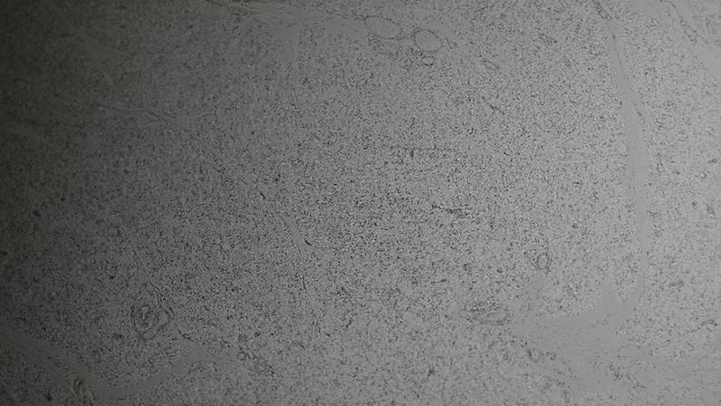 Gordura marrom: o ‘motor térmico’ do corpo humano em ação – depositphotos.com / jlcalvo@ucm.es