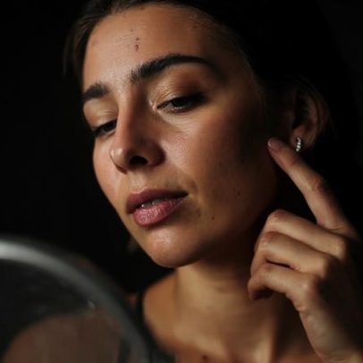 Ciclo menstrual irregular pode estar ligado a problemas de pele