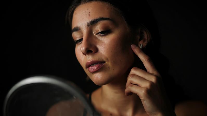 Desequilíbrios hormonais podem afetar a saúde da pele