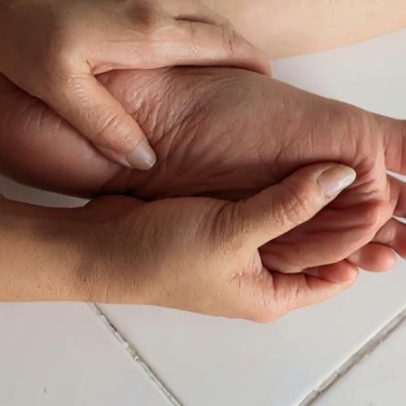 Fascite plantar: sintomas, causas e alerta apresentados de forma simples
