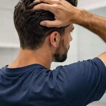 Procedimentos estéticos mais procurados no Brasil entre homens