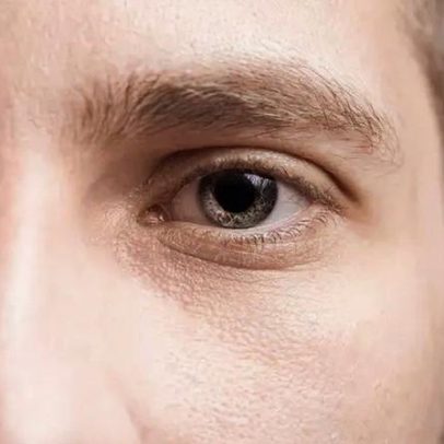 Traumas oculares: o que são e como prevenir acidentes