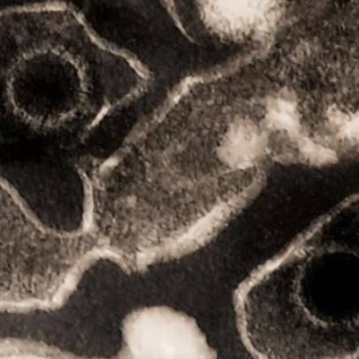 Cientistas revelam método para bloquear EBV, atingindo 95% da população