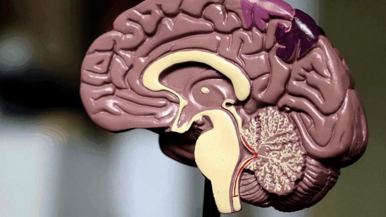O medicamento atua na remoção e na prevenção do acúmulo de placas beta-amiloide no cérebro