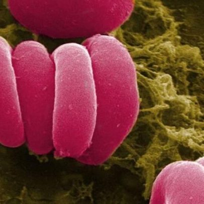 Microplásticos encontrados no sangue: o que a ciência sabe