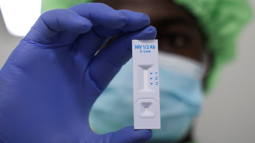 Funcionária da saúde mostra teste de detecção de HIV