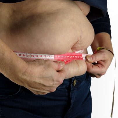 Obesidade é responsável por 10% das mortes por infecção