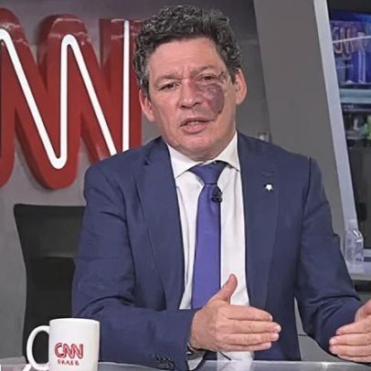 Autor da PEC da 6x1 defende tramitação da proposta de Hugo, segundo CNN