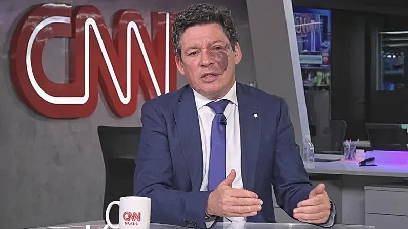 Reginaldo Lopes (PT-MG), deputado federal e coordenador do GT da Reforma Tributária na Câmara