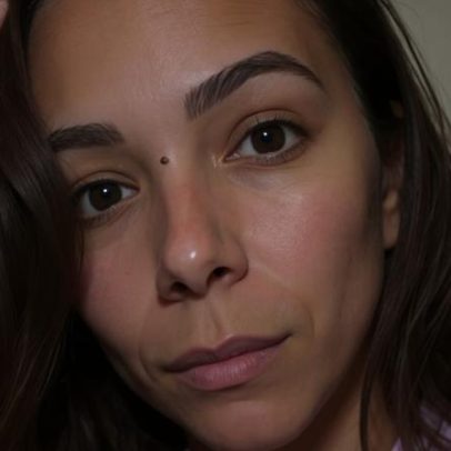 Belle Silva relata coceira após pré-treino; surge dúvida sobre normalidade