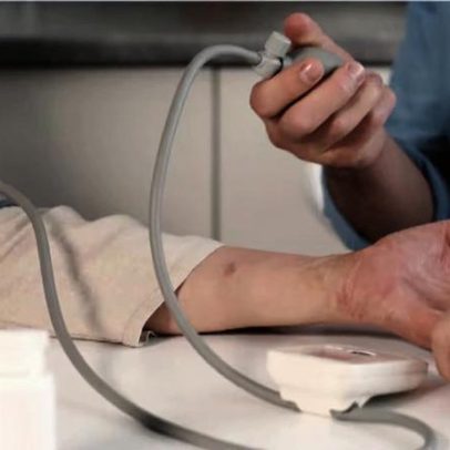 Hipertensão é principal causa de doença renal crônica, aponta estudo