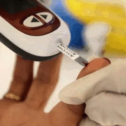 SUS incorpora transplante da membrana amniótica no tratamento do diabetes