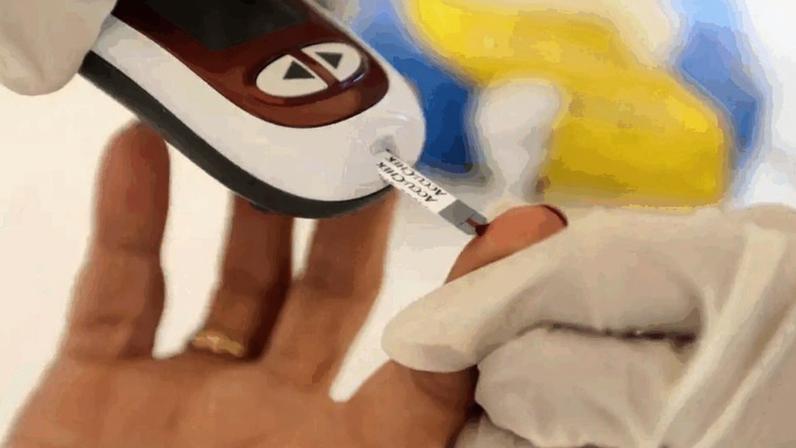 No SUS, ela já é utilizada no tratamento de queimaduras extensas desde 2025