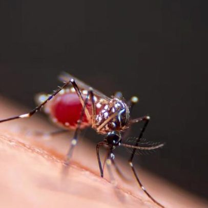 Dengue pode elevar 17 vezes o risco de Guillain-Barré, mostra estudo da Fiocruz