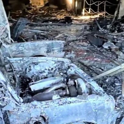 Pai de MC Gui fica queimado ao resgatar macaquinho de estimação do incêndio