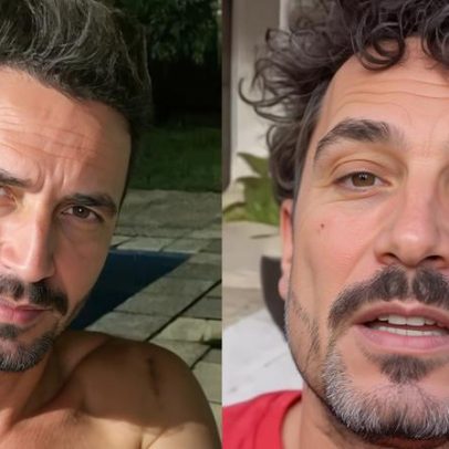 Latino exibe nova harmonização facial e gera repercussão nas redes