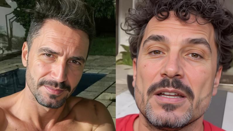 Latino exibe nova harmonização facial e gera repercussão nas redes