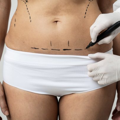 1º de abril: 5 mitos e verdades sobre cirurgia plástica