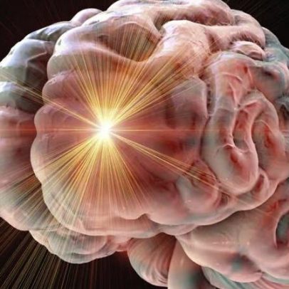 O que é glioma? Entenda pelo caso de Oscar Schmidt
