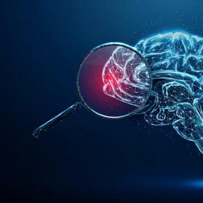 4 tipos de demência pouco conhecidos pela maioria