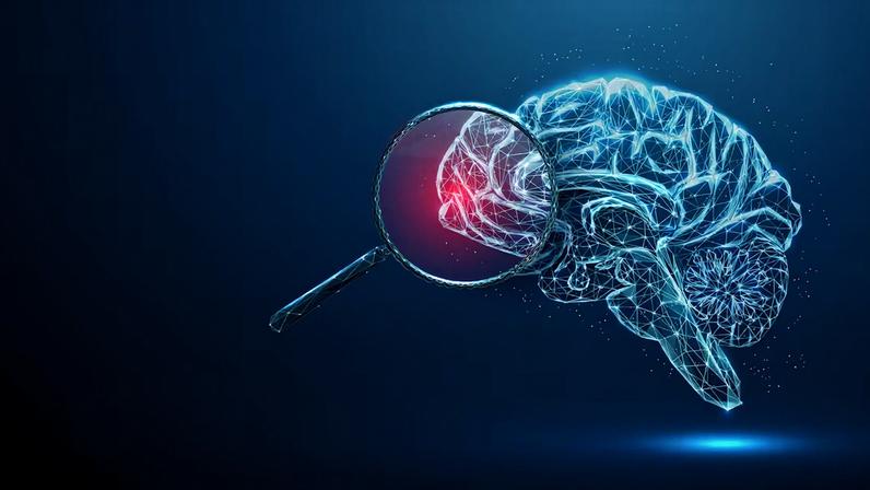 Alzheimer é o tipo mais conhecido de demência, mas está longe de ser o único