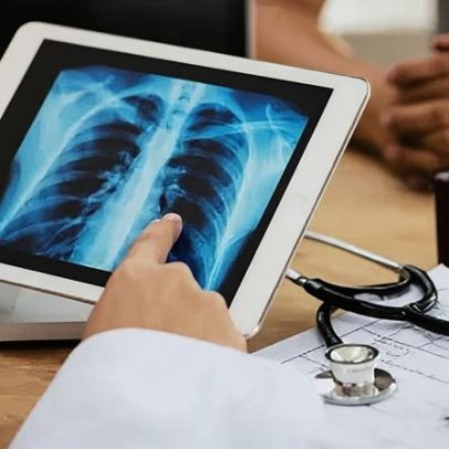 Casos de síndrome respiratória aumentam em bebês e levantam alerta no Brasil