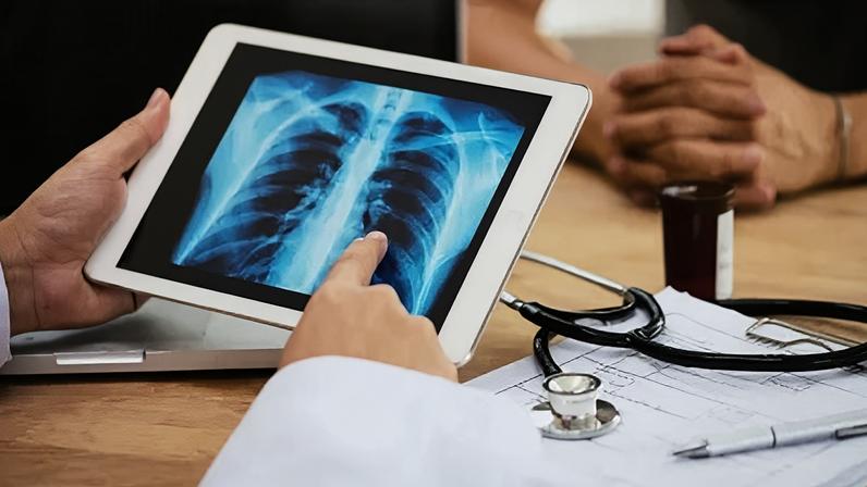 Casos de Síndrome Respiratória Aguda Grave (SRAG)