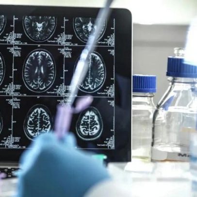 Dr. Kalil e neurologistas apontam despreparo do Brasil com envelhecimento