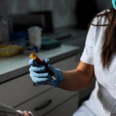 Atenção a pedidos de exames de rotina por médicos, avalie com cautela