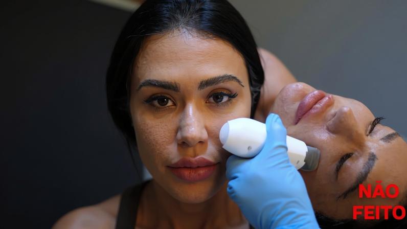 Além de Gracyanne, famosos que reverteram procedimentos estéticos