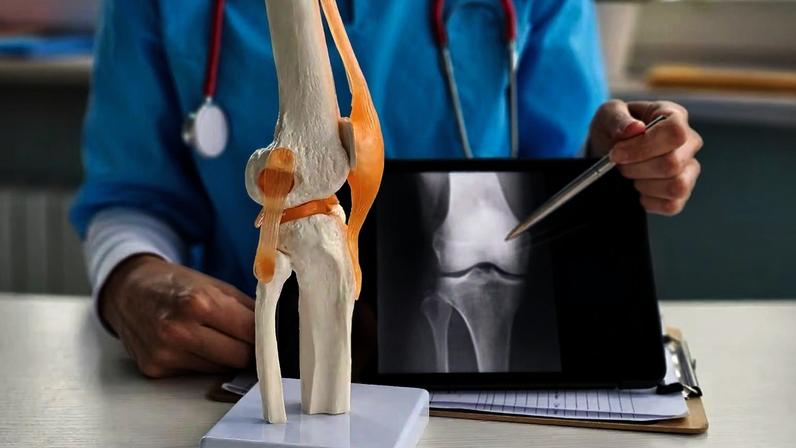 Alimentação pode influenciar avanço da artrite nos joelhos