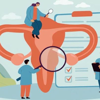 Seis sinais de endometriose que costumam ser ignorados