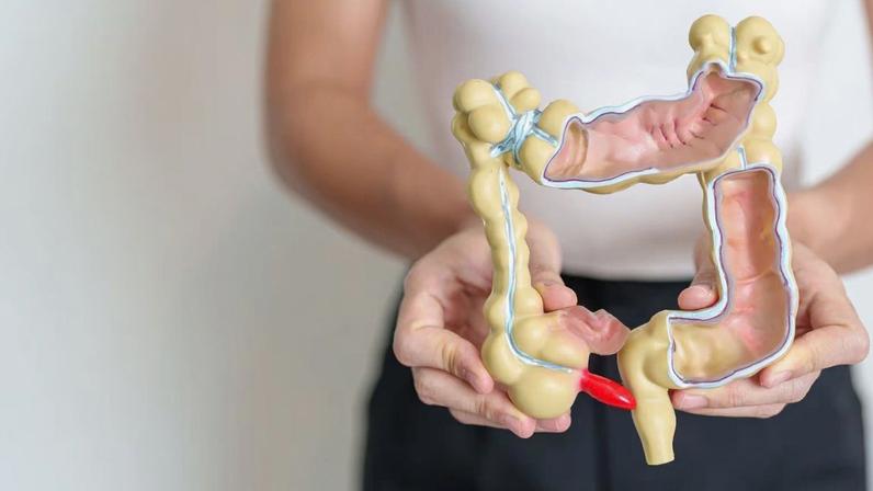 Ignorar etapa da dieta FODMAP pode prolongar a Síndrome do Intestino Irritável