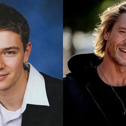Chad Michael Murray explica transformação facial após foto de anuário viral