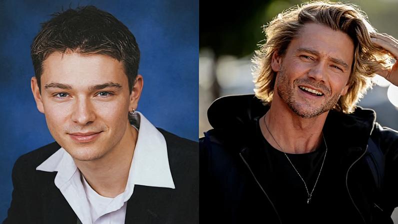 Chad Michael Murray explica transformação facial após foto de anuário viral
