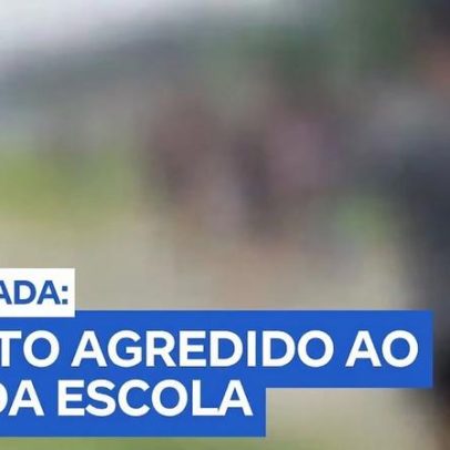 Adolescente de 14 anos é agredido por menores ao sair da escola no Guarujá