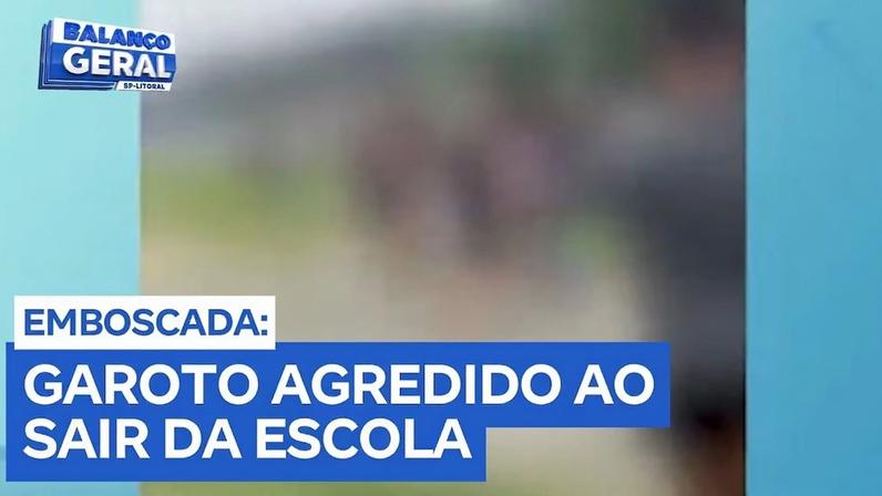 Adolescente de 14 anos é agredido por menores ao sair da escola no Guarujá